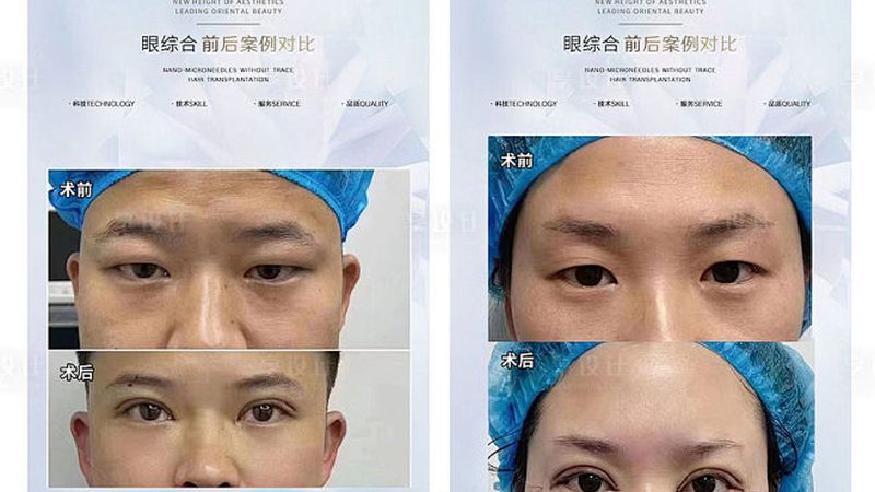 皮肤管理，从了解皮肤检测项目分类开始