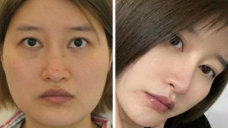 解读医美报价单：如何看清其中的“门道”**