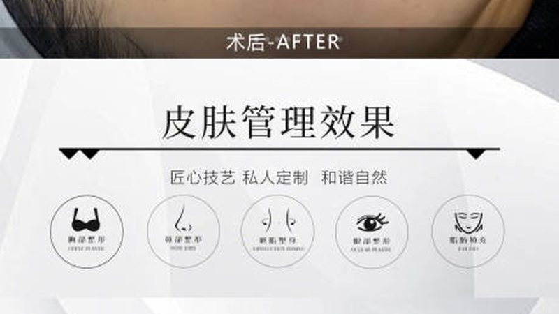 小型热玛吉加盟店标准揭秘：如何甄别优质加盟伙伴