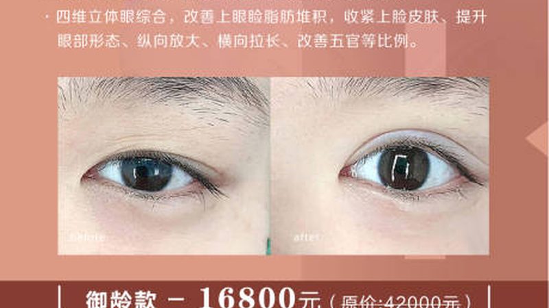 面部医美项目，价格透明度揭秘