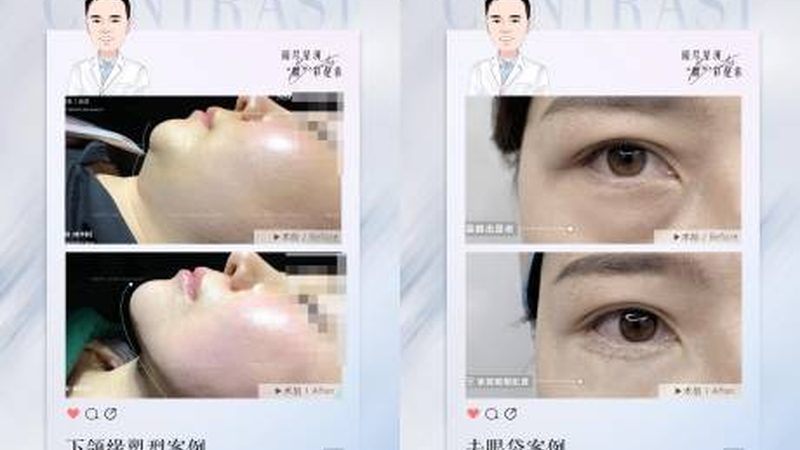 光子嫩肤团购，揭秘隐形消费陷阱
