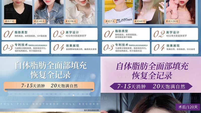成都双眼皮整形医院对比攻略