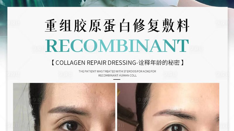 小标题：埋线提升的适用年龄