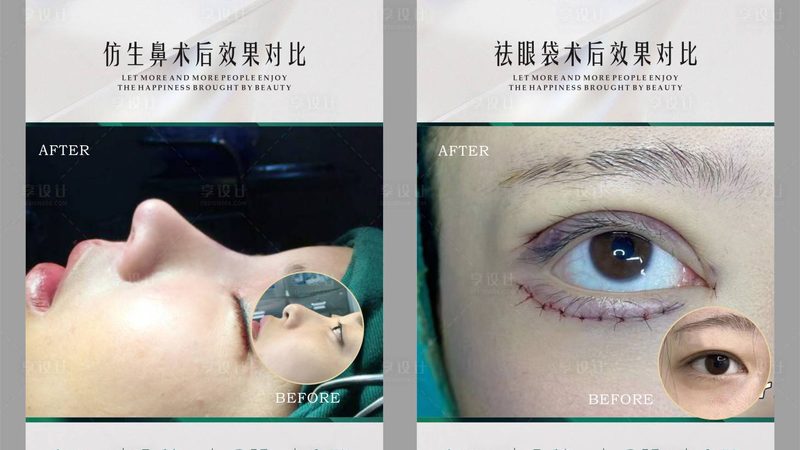 抗衰干细胞治疗：揭秘其原理与加盟成本**