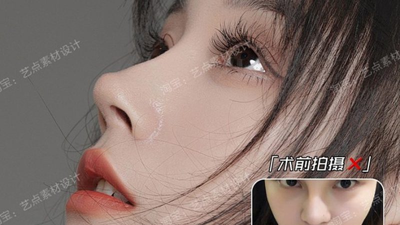 埋线提升：揭秘其优缺点与维持时间