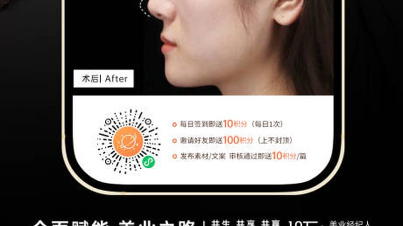 上海隆鼻医生鼻尖塑形技术：揭秘不同术式的特点与选择