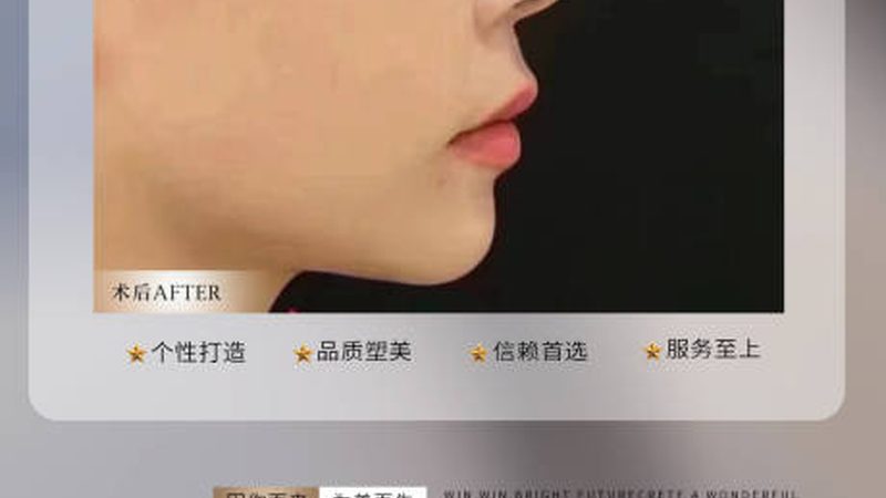 医美咨询师加盟注意事项