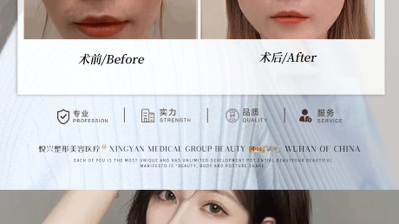 杭州整形医院隆胸手术：揭秘完整手术流程