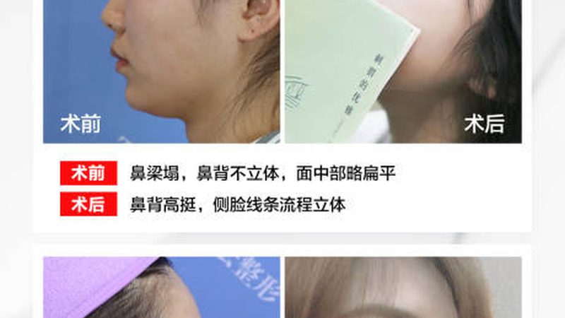 注射美容并非万能，这些疾病不宜尝试