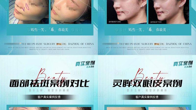 以下是一些在鼻综合整形领域具有良好口碑的广州医生推荐：