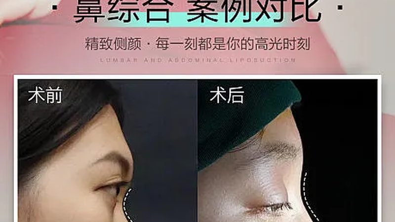 成都医美与轻医美：揭秘两者间的差异与选择要点