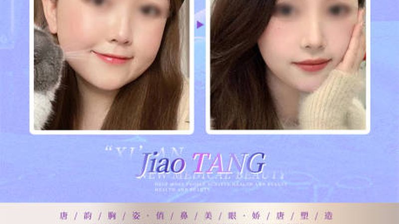 重庆光子嫩肤哪家医院性价比高
