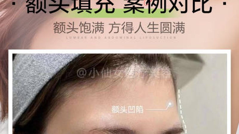 水光针术后化妆时间揭秘：保养与美丽并行